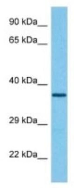 GAS2 Rabbit anti-Mouse, Polyclonal, Novus Biologicals 100 &mu;g; Unconjugated:Antibodies,